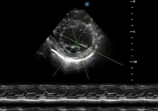 ANATOMIC M-MODE