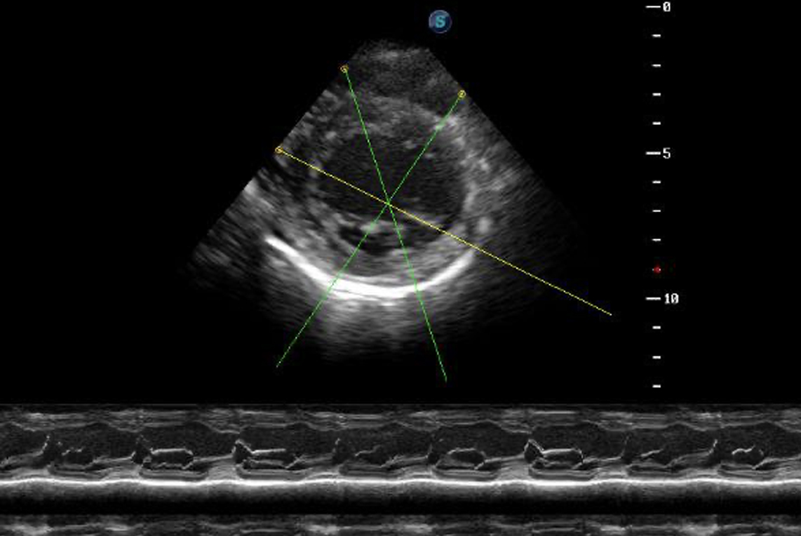 ANATOMIC M-MODE