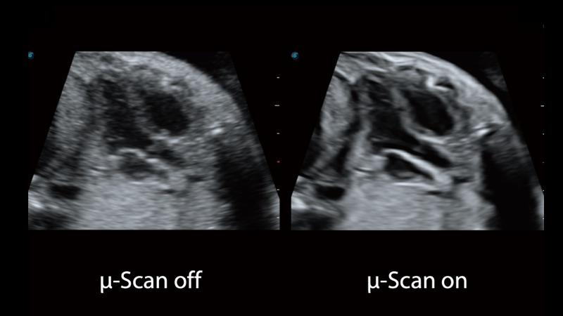 Microscan-plus