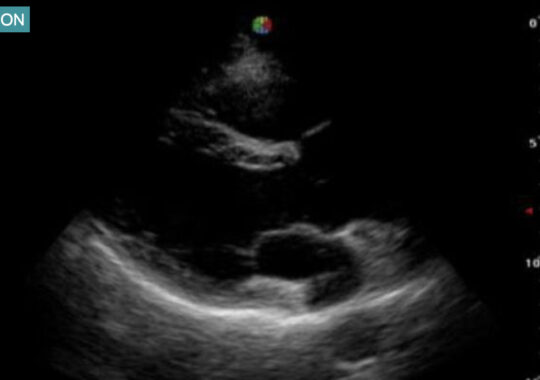 PULSE HARMONIC IMAGING