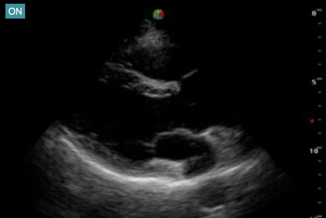 PULSE HARMONIC IMAGING