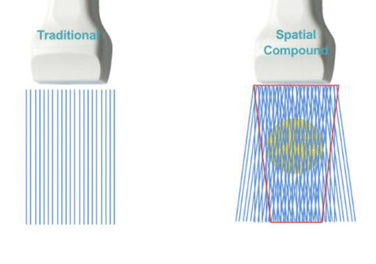 SPATIAL COMPOUND IMAGING