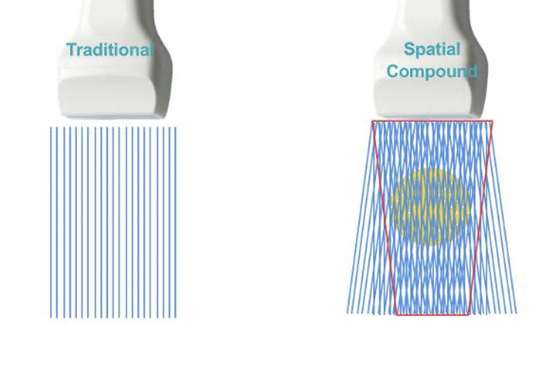 SPATIAL COMPOUND IMAGING